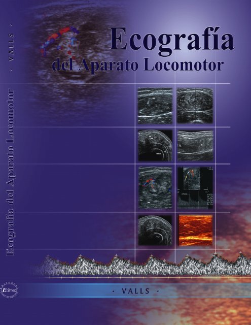 299. Anisotropía Tendón del Bíceps. – Ecografía Fácil