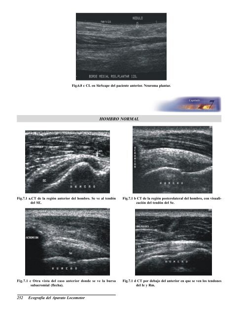 Ecografia del Aparato Locomotor.pdf