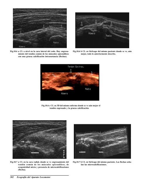 Ecografia del Aparato Locomotor.pdf