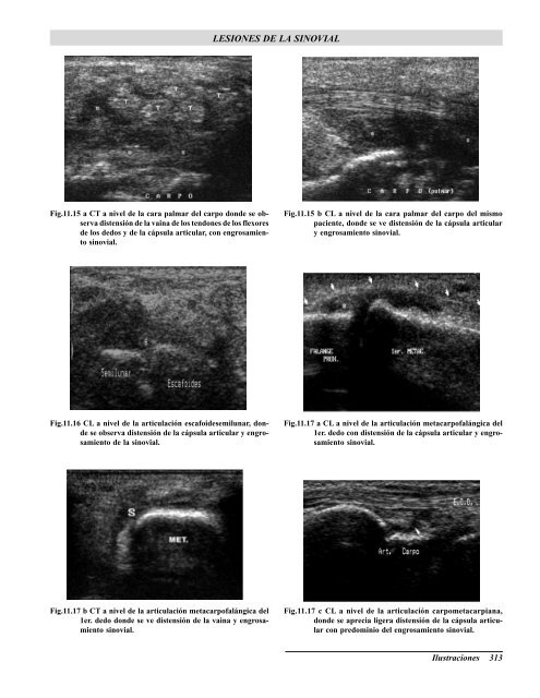 Ecografia del Aparato Locomotor.pdf