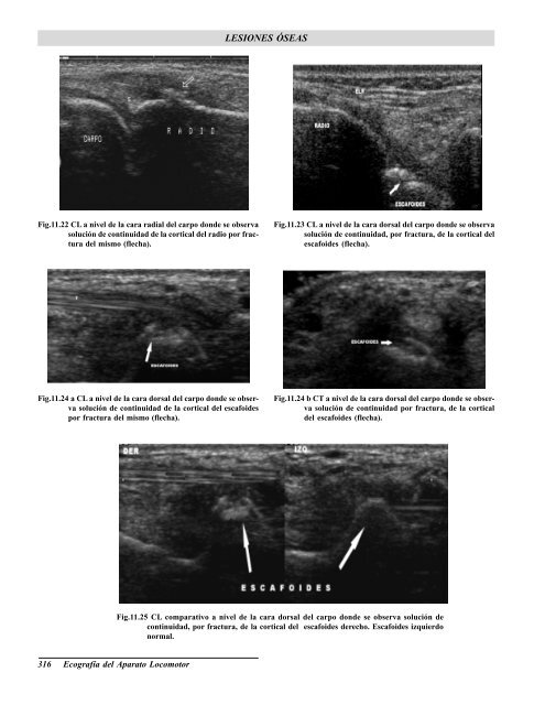 Ecografia del Aparato Locomotor.pdf