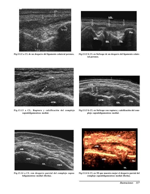 Ecografia del Aparato Locomotor.pdf