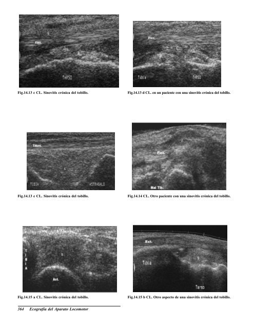 Ecografia del Aparato Locomotor.pdf