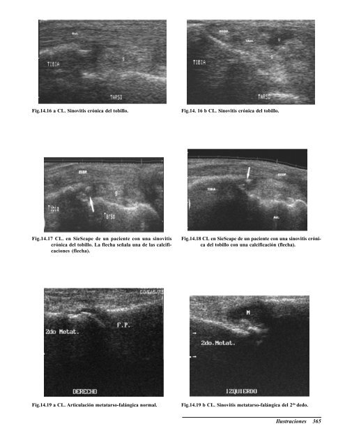 Ecografia del Aparato Locomotor.pdf