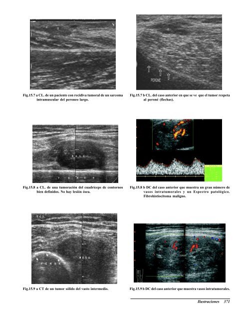 Ecografia del Aparato Locomotor.pdf