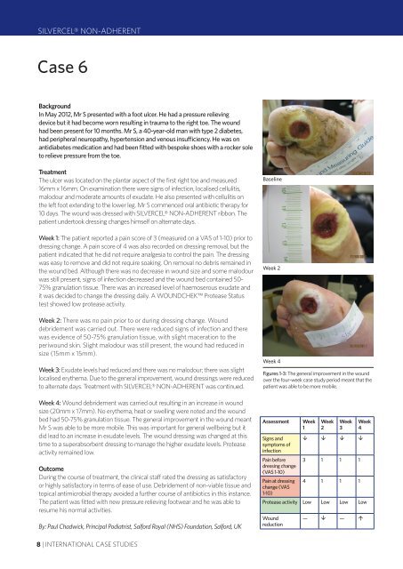 VIEW PDF - Wounds International