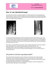 Was ist eine Metallentfernung? - Eric Castenholz