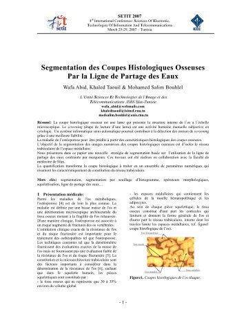 Segmentation des Coupes Histologiques Osseuses Par la Ligne de ...