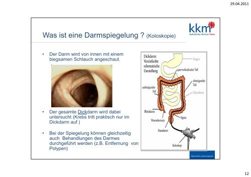 Vorsorge- Koloskopie - Katholisches Klinikum Mainz