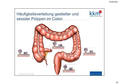 Vorsorge- Koloskopie - Katholisches Klinikum Mainz