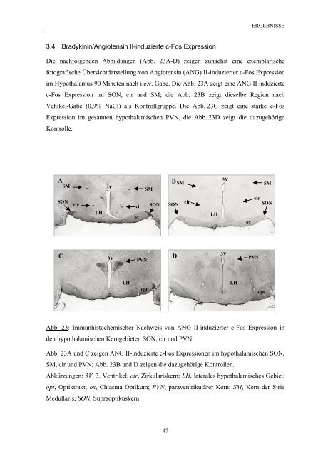 Beteiligung an der Pathogenese von spontan hypertensiven Ratten?