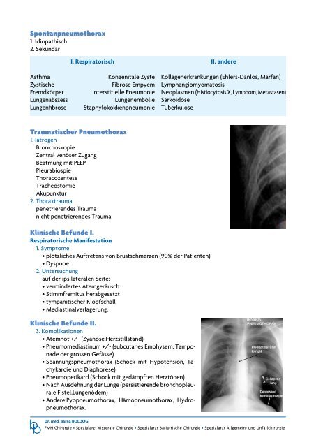 Pneumothorax - Dr. med. Barna BOLDOG Minimal invasive Chirurgie