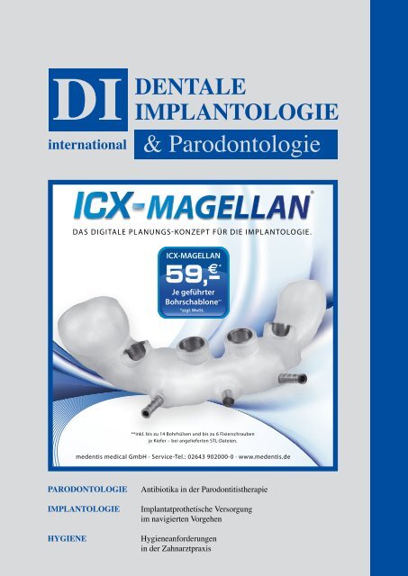 implantatfreilegung schwangerschaftsdiabetes implantatfreilegung schwangerschaftsdiabetes