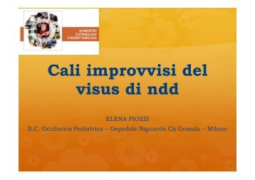 Cali improvvisi del visus di ndd