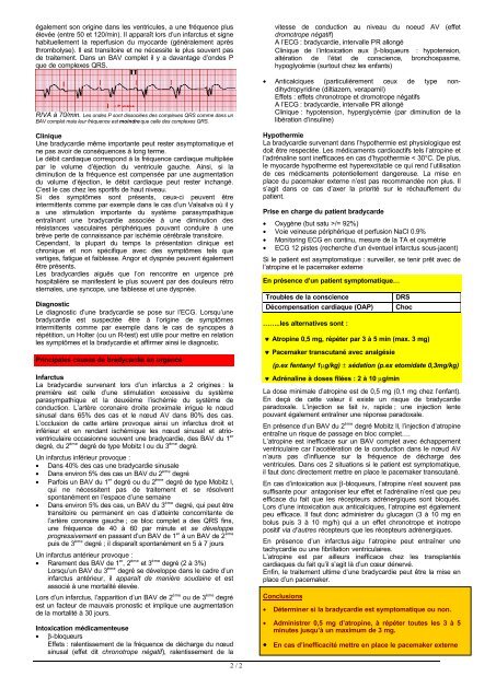 Bulletin SMUR NÃ‚Â°30, bradycardies - Swissrescue