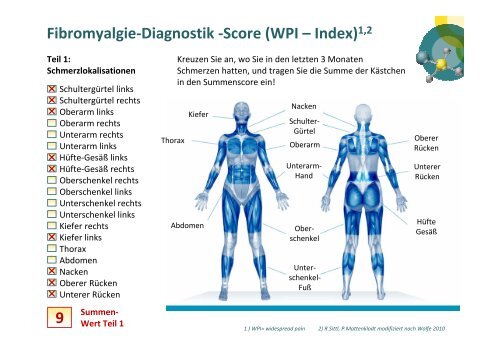 Fibromyalgie