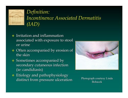 Incontinence Associated Dermatitis