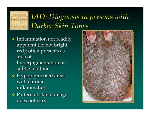 Incontinence Associated Dermatitis