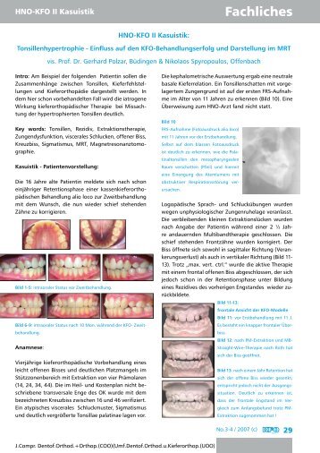 HNO-KFO II, Tonsillen, Mandeln, offener Biss - KieferorthopÃƒÂ¤dische ...