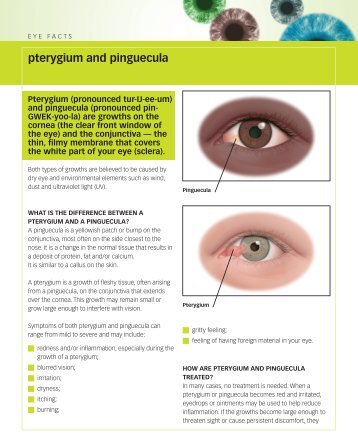 pterygium and pinguecula - Oregon Eye Specialists