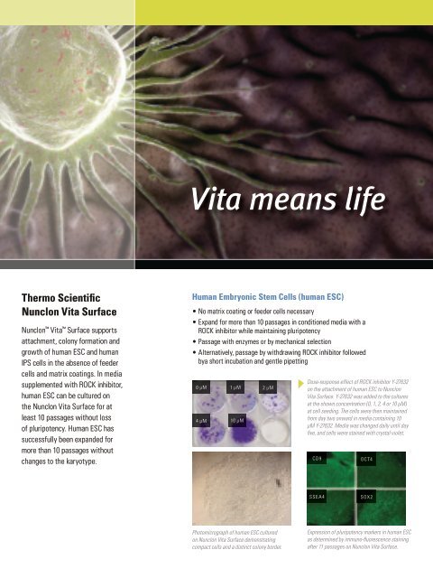 Vita means life - Alab