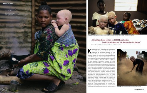 Albinos - Kontinente