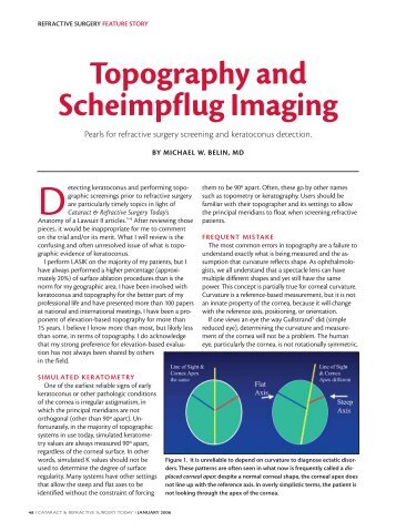 Topography and Scheimpflug Imaging [112 KB] - Oculus