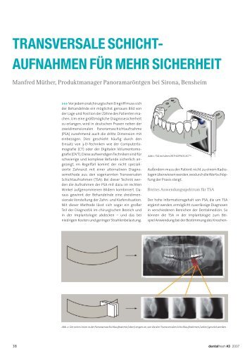 Transversale Schichtaufnahmen fÃ¼r mehr Sicherheit - zahniportal.de