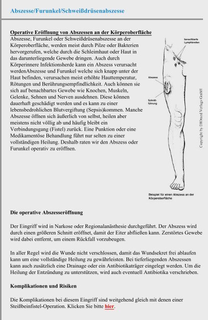 Abszesse/Furunkel/Schweißdrüsenabszesse - Chirurgie Heidelberg