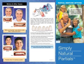 Simply Natural Partials - Glidewell Dental Labs