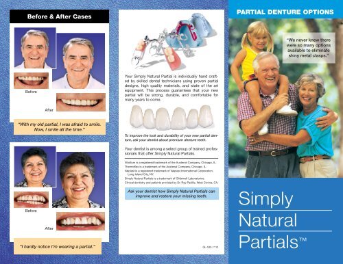 Simply Natural Partials - Glidewell Dental Labs