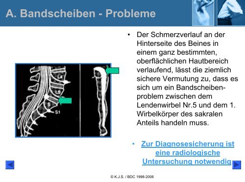 Ischialgie-Hexenschuss Lumbago - Bund deutscher Chiropraktiker ...