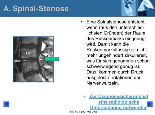 Ischialgie-Hexenschuss Lumbago - Bund deutscher Chiropraktiker ...