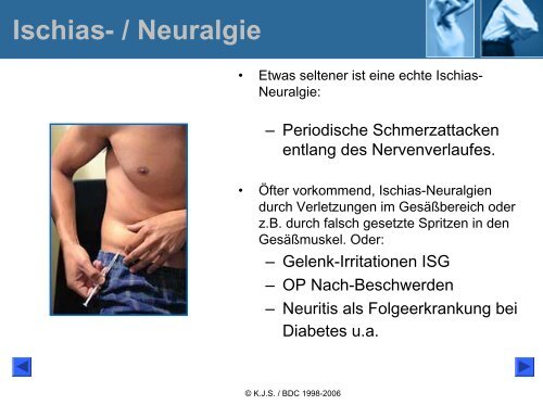 Ischialgie-Hexenschuss Lumbago - Bund deutscher Chiropraktiker ...