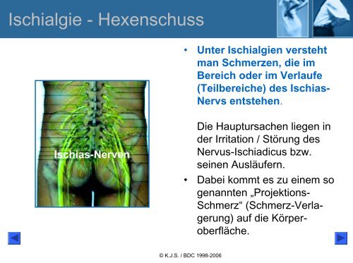 Ischialgie-Hexenschuss Lumbago - Bund deutscher Chiropraktiker ...