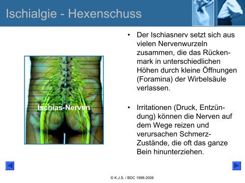 Ischialgie-Hexenschuss Lumbago - Bund deutscher Chiropraktiker ...