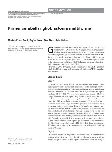 Primer serebellar glioblastoma multiforme - Diagnostic and ...