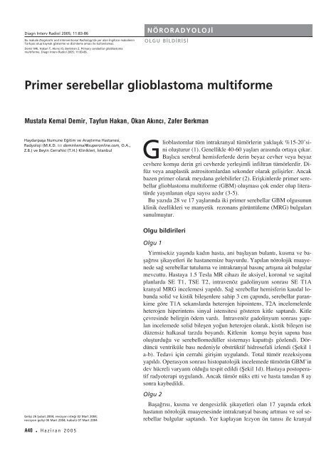 Primer serebellar glioblastoma multiforme - Diagnostic and ...