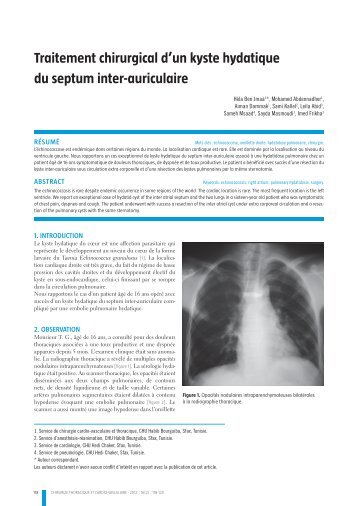 Traitement chirurgical d'un kyste hydatique du septum inter ... - sfctcv