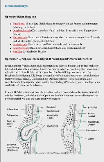 Hernienchirurgie - Chirurgie Heidelberg