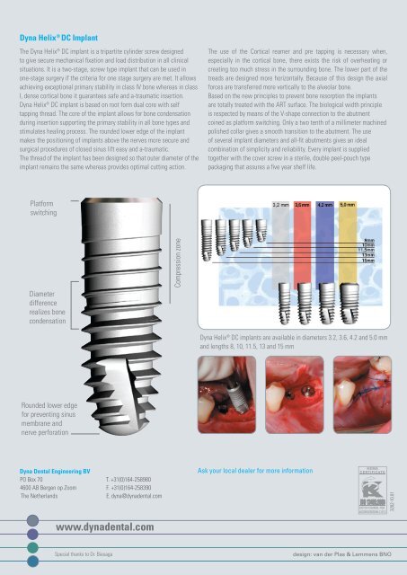 Dyna Helix® DC Implant - Dyna Dental