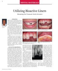 Utilizing Bioactive Liners - Eureka Smile Center