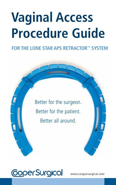 Lone Star APS Procedure Guide - CooperSurgical