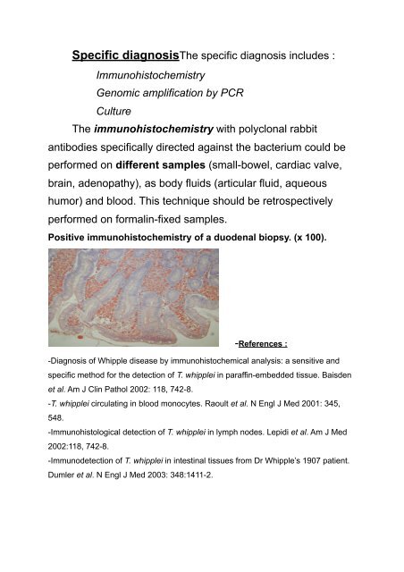 Whipple's disease and Tropheryma whipplei