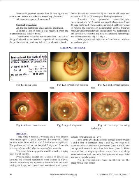 treatment of perforated infectious corneal ulcers - Journal of IMAB