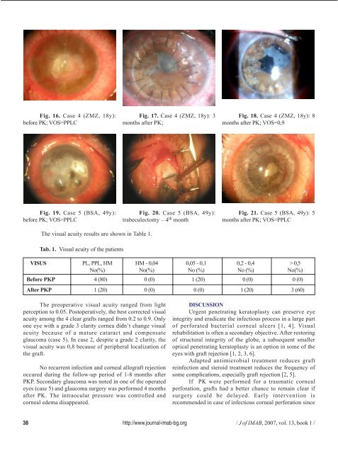 treatment of perforated infectious corneal ulcers - Journal of IMAB