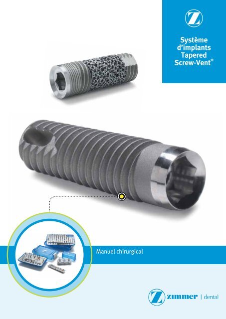 SystÃƒÂ¨me d'implants Tapered Screw-VentÃ‚Â® - Zimmer Dental