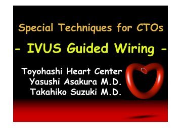 IVUS Guided Wiring - summitMD.com