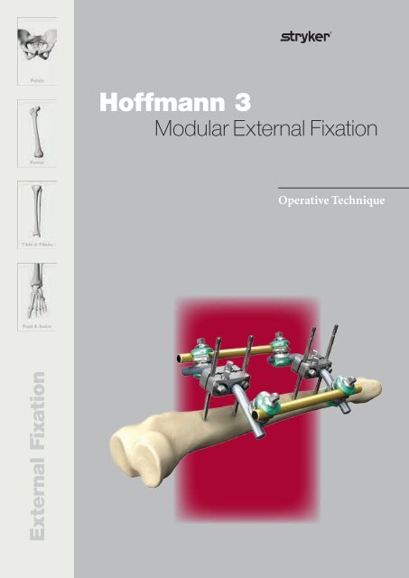 Hoffmann 3 Operative Technique - Stryker