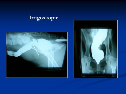 Chirurgie an Perineum, Rectum und Anus